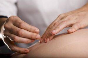 Trigger Point Acupuncture for Sciatica